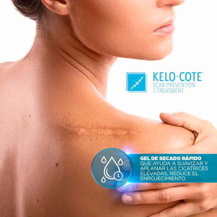 Kelo-Cote® Gel 15G