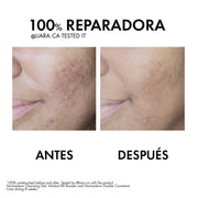 Vichy Normaderm Phytosolution Tratamiento Anti Imperfecciones 50Ml - Farmacias Arrocha