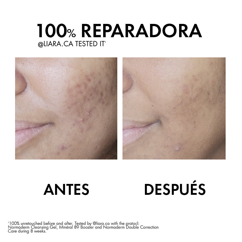 Vichy Normaderm Phytosolution Tratamiento Anti Imperfecciones 50Ml - Farmacias Arrocha