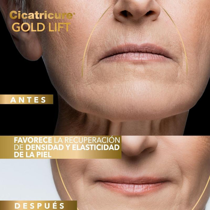 Cicatricure Gold Lift Dia