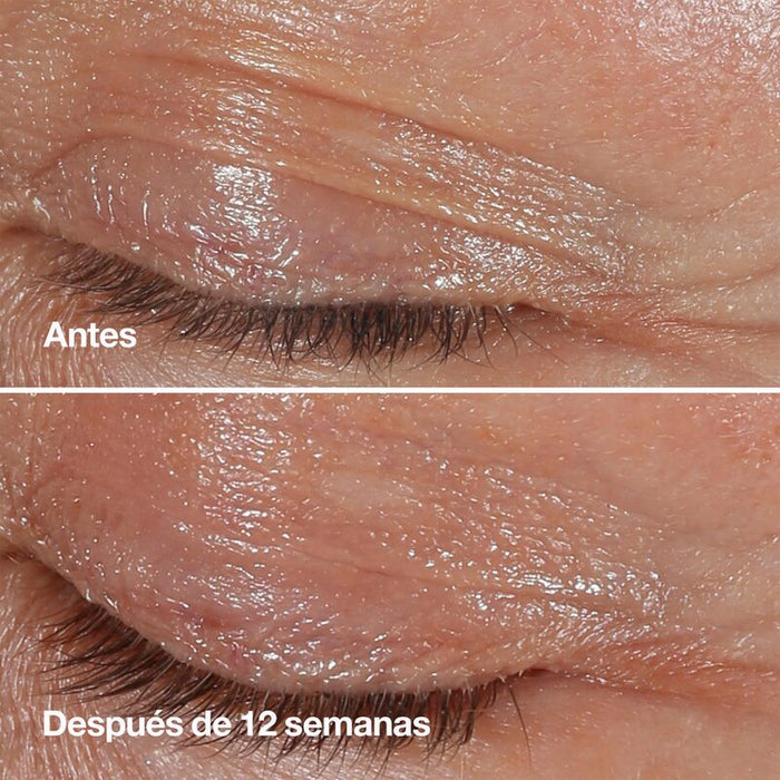 Clinique Crema Contorno de ojos Smart Clinical™ Antiarrugas 15 ml - Farmacias Arrocha