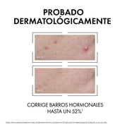 Vichy Normaderm Serum Anti - imperfecciones 30ml - Farmacias Arrocha