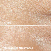 Clinique Crema Hidratante Smart Clinical Repair ™ Antiarrugas 50 ml - Farmacias Arrocha