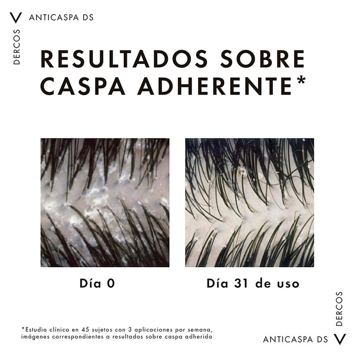 Vichy Dercos Shampoo Anti Caspa 390Ml - Farmacias Arrocha