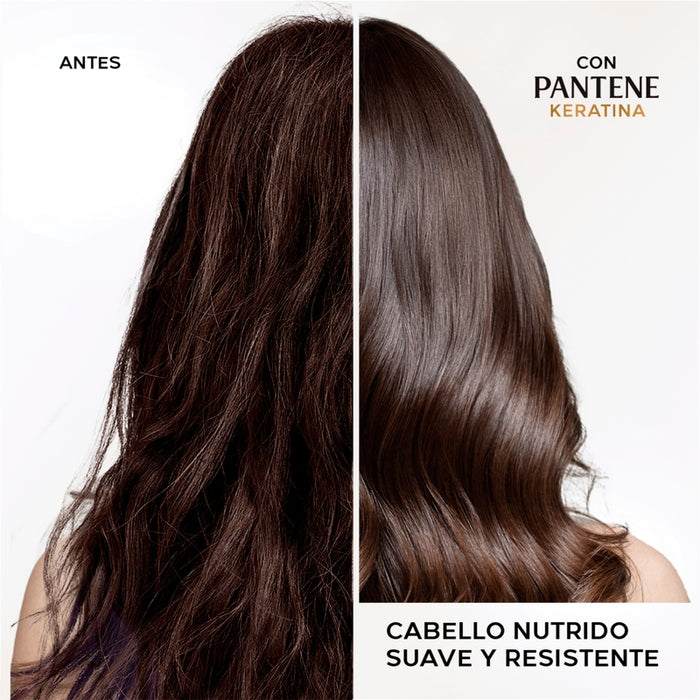 Shampoo Reparador Pantene Pro-v Miracles Keratina Repara Y Protege 300 ml