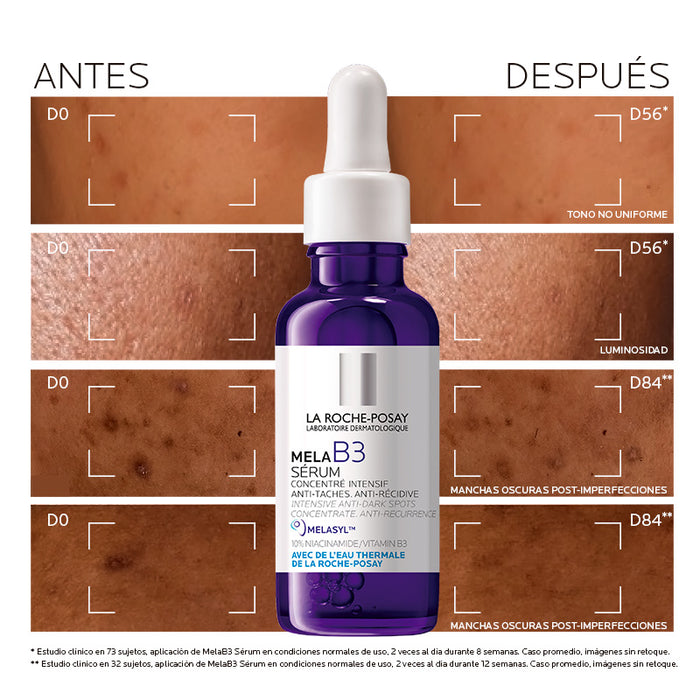 La Roche Posay Mela B3 Serum Anti Manchas Con Niacinamida 30ml