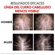 VICHY DERCOS SÉRUM FORTALECEDOR ANTÍCADA REGEN BOOSTER DE 90 ML - Farmacias Arrocha