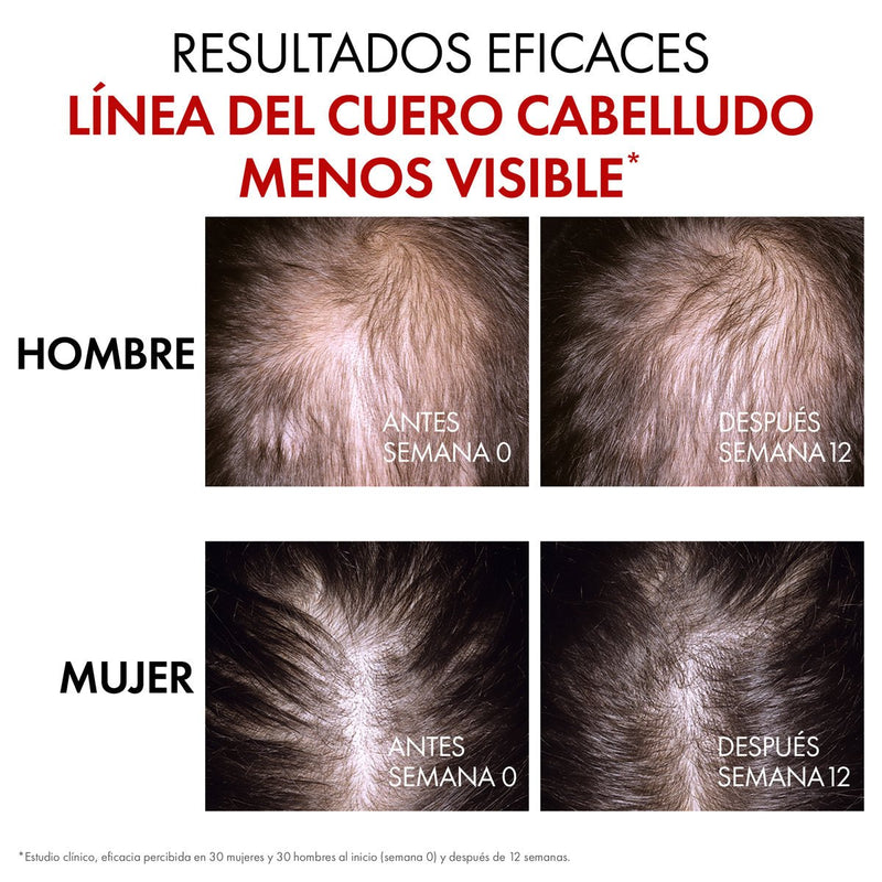 VICHY DERCOS SÉRUM FORTALECEDOR ANTÍCADA REGEN BOOSTER DE 90 ML - Farmacias Arrocha