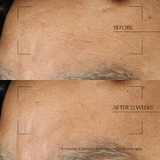 Estée Lauder Tratamiento Nocturno Advanced Night Repair 65 ml - Farmacias Arrocha