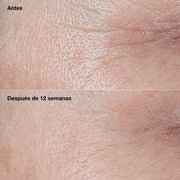 Clinique Crema Humectante Smart Clinical Repair™ Antiarrugas Spf 30 50 Ml - Farmacias Arrocha