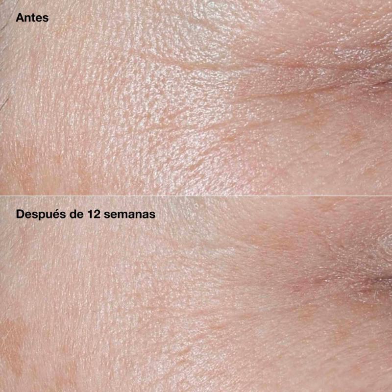 Clinique Crema Humectante Smart Clinical Repair™ Antiarrugas Spf 30 50 Ml - Farmacias Arrocha