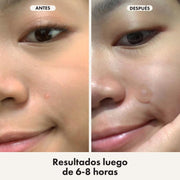 Hero Mighty Patch Duo Para Acne 12 Unds - Farmacias Arrocha