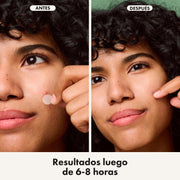 Hero Mighty Patch Invisible Parches Para Acné Ultra Finas Para Rostro 24 Unds - Farmacias Arrocha