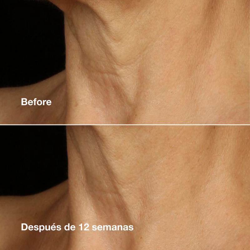 Clinique Crema Humectante Smart Clinical Repair™ Lift Rostro Y Cuello Antiedad 50 Ml - Farmacias Arrocha