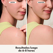 Hero Mighty Patch Surface Para Acné 10 Unds - Farmacias Arrocha