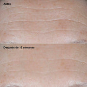 Clinique Crema Humectante Smart Clinical Repair™ Antiarrugas Spf 30 50 Ml - Farmacias Arrocha