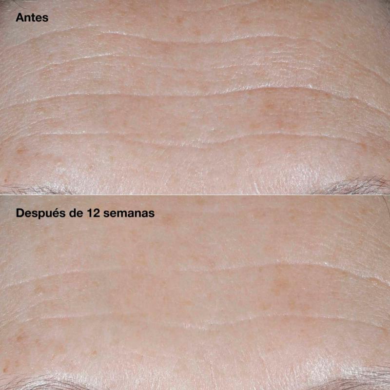 Clinique Crema Humectante Smart Clinical Repair™ Antiarrugas Spf 30 50 Ml - Farmacias Arrocha