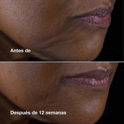 Clinique Crema Humectante Smart Clinical Repair™ Lift Rostro Y Cuello Antiedad 50 Ml - Farmacias Arrocha