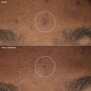 Clinique Crema Hidratante Even Better Clinical™ Antimanchas 15 ml - Farmacias Arrocha