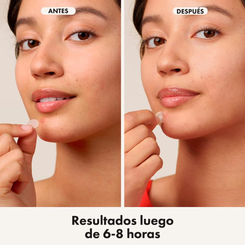 Hero Mighty Patch Original Parches Para Acné 24 Unds - Farmacias Arrocha