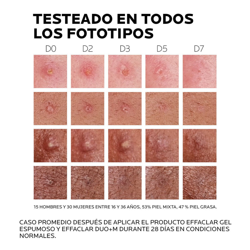 Effaclar duo + M piel grasa 15ml - Farmacias Arrocha