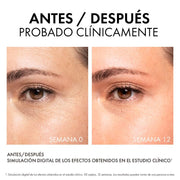 Vichy Liftactiv Collagen Specialist 16 Serum - Farmacias Arrocha