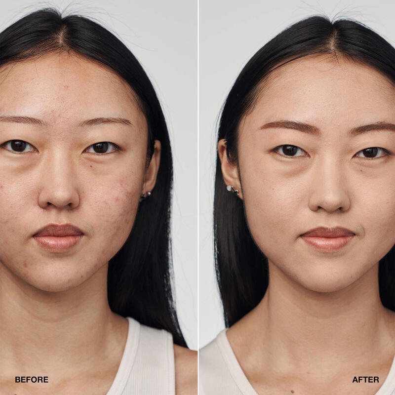 Clinique Base De Maquillaje y Suero Even Better Clinical™  SPF 20 30Ml - Farmacias Arrocha