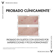 Vichy Normadem Serum Anti-imperfecciones 30ml - Farmacias Arrocha