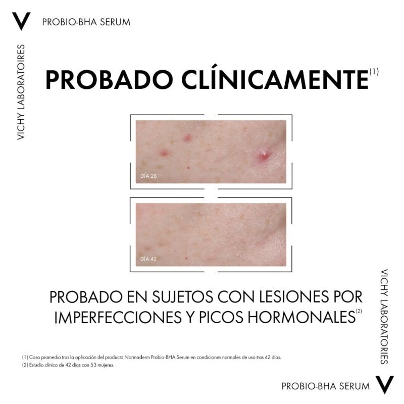 Vichy Normadem Serum Anti-imperfecciones 30ml - Farmacias Arrocha